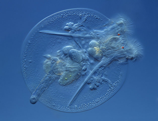 Illustration for article titled Remarkable Nikon Small World Microscope Photography Winners